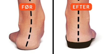 Sportiq™ PowerStep